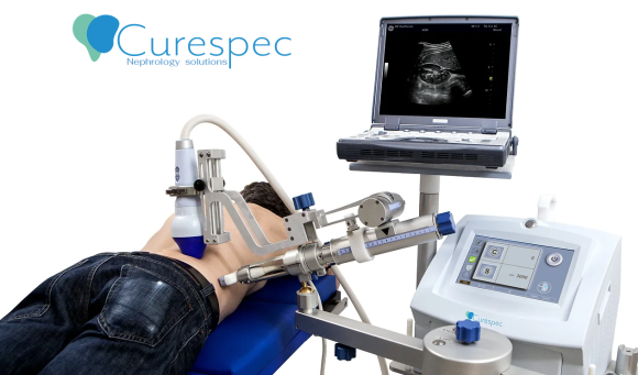 CureSpec | Noninvasive Shockwave Device for Treating Hypertension and Chronic Kidney Disease